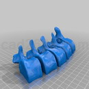 3D打印模型腰椎